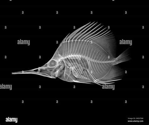 Longnose Butterflyfish Forcipiger Longirostris X Ray Of A Section