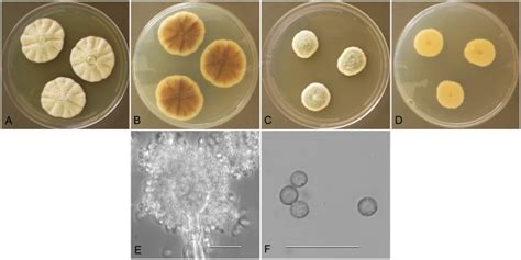 Aspergillus Tabacinus Nrrl Culture Plates Are Cm Diam