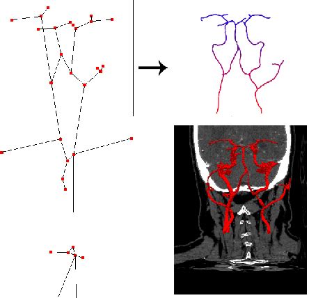 Figure From Patient Specific Blood Flow Modelling For Medical