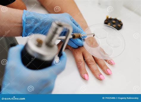 Removal Of Warts In Dermatology Clinic Stock Photo Image Of