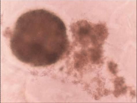 Figure 3 From Diagnosis And Treatment Of Bovine Ovine And Equine