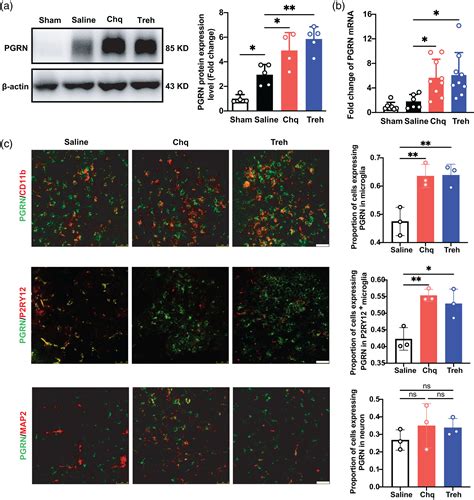 Progranulin Released From Microglial Lysosomes Reduces Neuronal