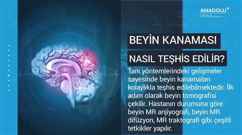 Beyin Kanamas Nedir Beyin Kanamas Belirtileri Nelerdir Youtube