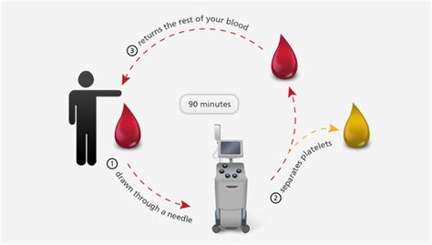 Platelets Donation Process - Irish Blood Transfusion Service