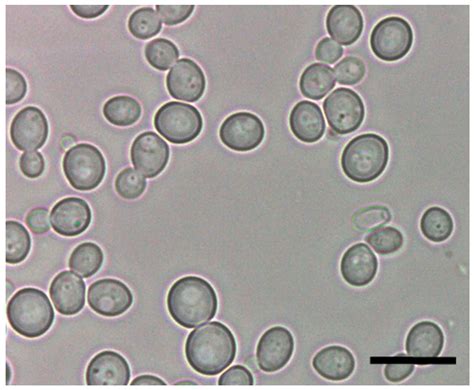 Saccharomyces Cerevisiae Under Light Microscope