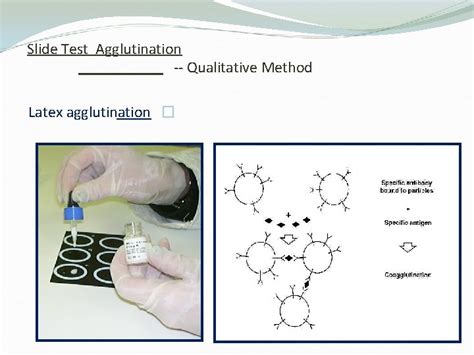 Agglutination Definition the clumping together of antigen bearing 