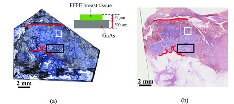 A Photograph Of A Formalin Fixed Paraffin Embedded Ffpe Breast Download Scientific Diagram