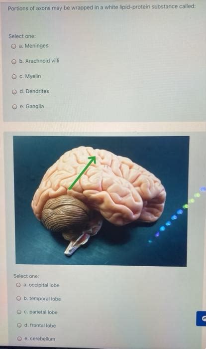 Solved Be Select One O A Thalamus O B Anterior Commissure Chegg