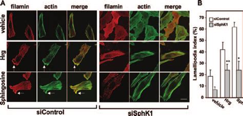 SphK1 Is Required For Hrg And Sphingosine Induced Lamellipodia