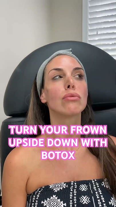 Botox Lip Flip And Dao Muscle Botox Lipflip Botox101 Botoxeducation Youtube