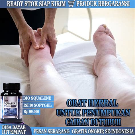 Jual Obat Alami Penumpukan Cairan Di Kaki Obat Edema Bengkak Di Tubuh