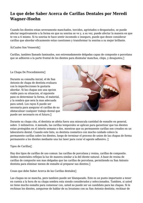 Lo Que Debe Saber Acerca De Carillas Dentales Por Meredi Wagner Hoehn Pdf