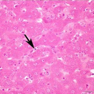 Section Of Intoxicated Mouse Liver With Ccl Showing Hepatocellular