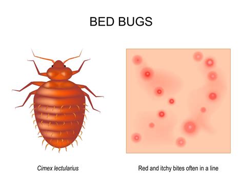 Bed Bug Bites Vs Other Insect Bites What Are The Differences