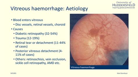 Disorders Of The Vitreoretinal Interface Ii Flashcards Quizlet