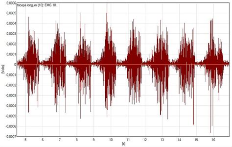 Por qué se realiza una electromiografía