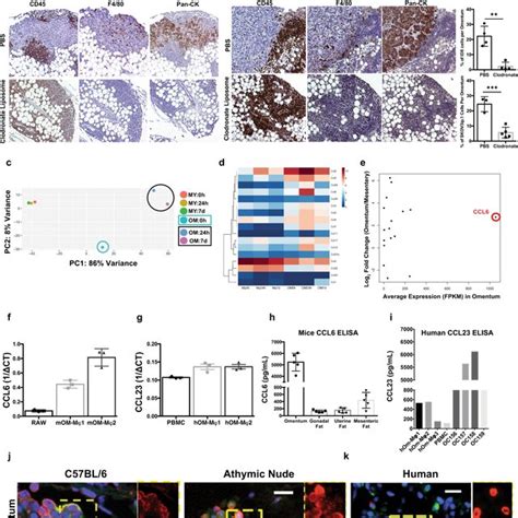 Omentum As A Niche For Ovarian Cancer Metastasis A Representation Of A