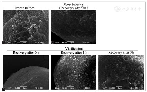 Vitrification Versus Slow Freezing Of Human Oocytes Effects On