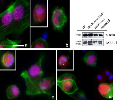 Immunolabeling And Western Blotting Of PARP 1 Fluorescent Microscopy