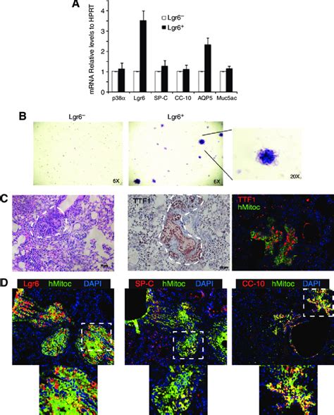 Stage II Lgr6 þ tumor cells are more tumorigenic than Lgr6 À cells and