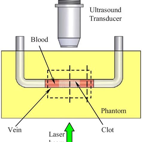 Diagram Of A Phantom And An Experimental Setup Used In Ultrasound And Download Scientific