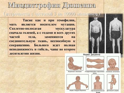 Генетические заболевания - презентация онлайн
