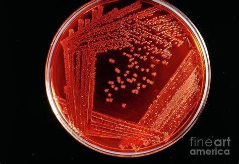 Culture Of Salmonella Typhi Bacteria Photograph By John Durhamscience