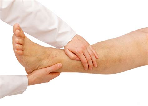 The Hidden Dangers Of Untreated Varicose Veins Dr Mackay Vein