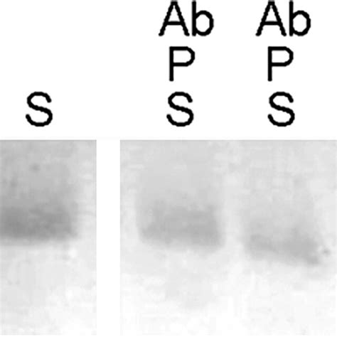 Protease Activity Assay With Substrate Peptide R1N5 S Substrate