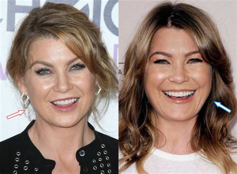 Has Ellen Pompeo Had Cosmetic Surgery? (Before & After Photos)