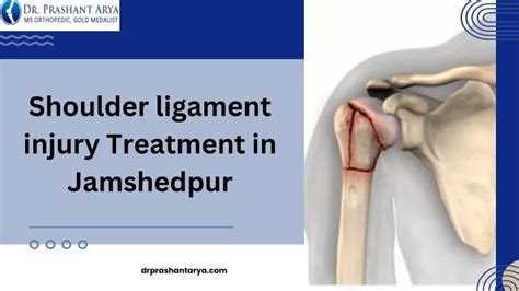 PPT - Shoulder ligament injury Treatment in Jamshedpur PowerPoint Presentation - ID:12953278