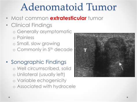 Ppt Scrotal Ultrasound Powerpoint Presentation Id 5671926