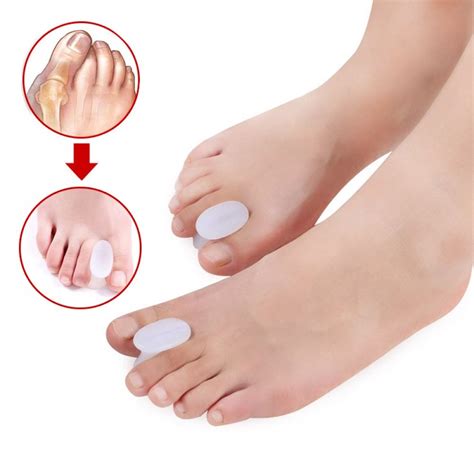 Omeny Hallux Valgus Juanete Protectores Toe Separadores De Gel De