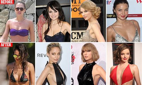 Celebrity Plastic Surgery Breast Implants Before And After