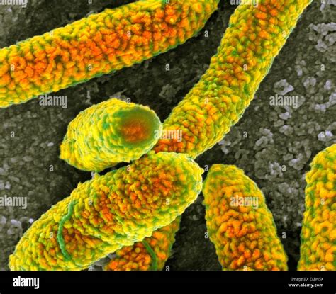 Scanning Electron Microscope E Coli Hi Res Stock Photography And Images