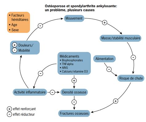 Spondylarthrite ankylosante et ostéoporose intervenir à temps