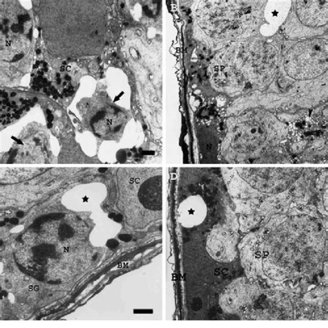 Electron Micrographs Of Seminiferous Tubules From Irradiatedrats And