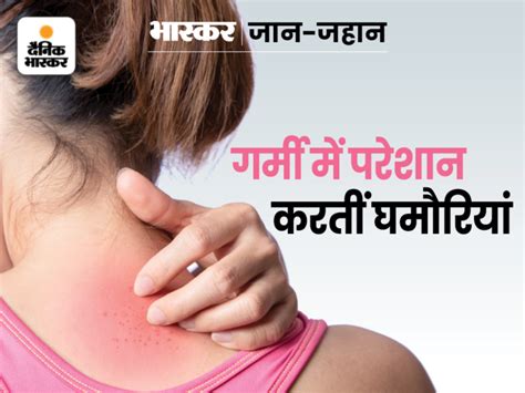 Bacteria Stop The Way Of Sweating Relief From Multani Mitti Neem And Cucumber आलू दही से