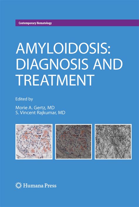 Pdf Imaging Of Systemic Amyloidosis