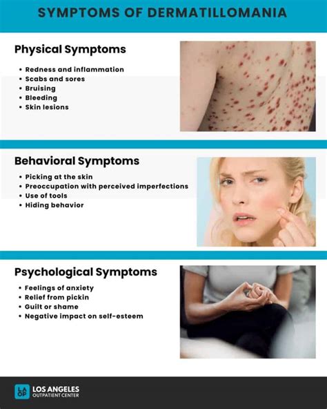 Excoriation Disorder Dermatillomania Skin Picking Disorder Symptoms