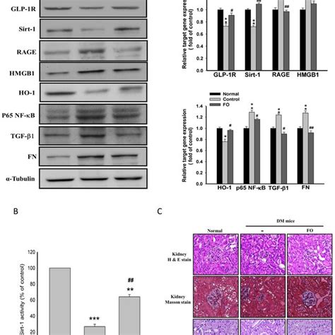 The Effects Of Fucoidan On Fibrosis Related Gene Expression Sirt 1