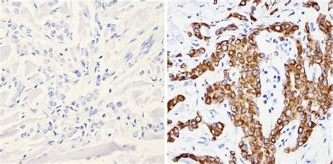 Cytokeratin Pan Type I Ii Antibody Cocktail Invitrogen L