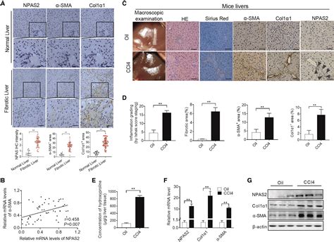 Npas Contributes To Liver Fibrosis By Direct Transcriptional