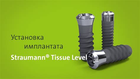 Установка имплантата Straumann® Tissue Level Youtube