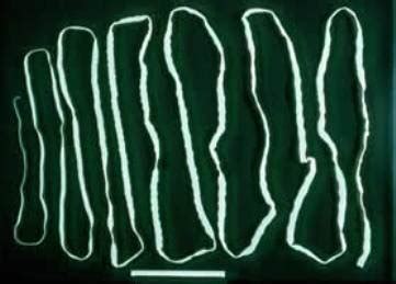 GoryFiles: Gross Human Parasitic Worms II - Tapeworms