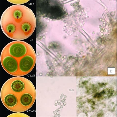 Aspergillus Creber A From Top To Bottom Colonies On MEA CZ CY20S