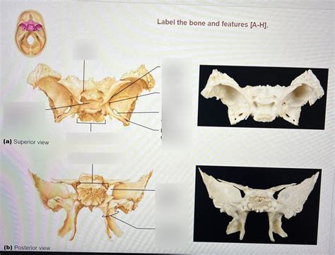 cranial bones Diagram | Quizlet