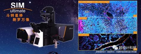 专注活细胞超分辨智能成像——his Sim国产显微镜 广州超视计生物科技有限公司