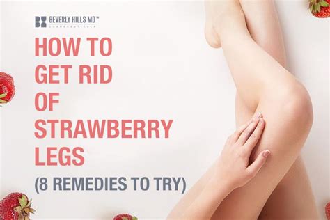 Strawberry Legs Try These 8 Remedies Beverly Hills Md