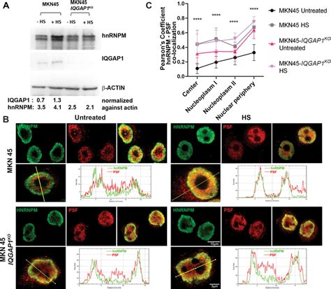 IQGAP1 Regulates The Exchange Of HnRNPM Between The Nuclear Matrix And